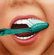 dental_cleaning_1