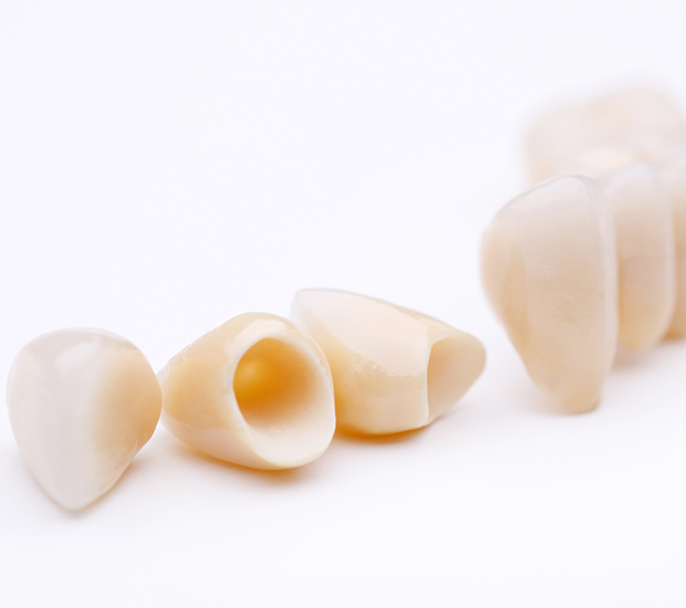 Piscataway Dental Crowns and Dental Bridges